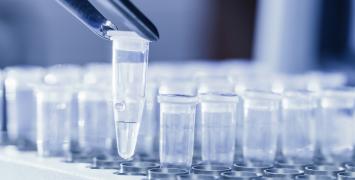 W Kenii zabrakło pieniędzy na badania antydopingowe